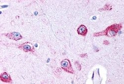 HTR2B Polyclonal Antibody, Invitrogen&trade;
