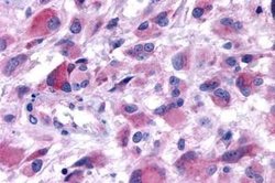 HTR2B Polyclonal Antibody, Invitrogen&trade;