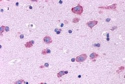 HTR2B Polyclonal Antibody, Invitrogen&trade;