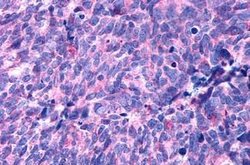 HTR2B Polyclonal Antibody, Invitrogen&trade;