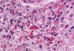 Invitrogen GPR64 Polyclonal Antibody 25 &mu;g; Unconjugated:Antibodies,