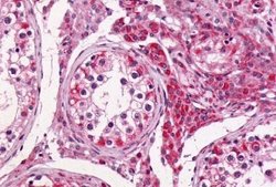 Invitrogen GPR64 Polyclonal Antibody 25 &mu;g; Unconjugated:Antibodies,