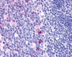 GPCR ORF4 Polyclonal Antibody, Invitrogen 25 &mu;g; Unconjugated:Antibodies,