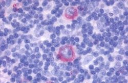 GPCR ORF4 Polyclonal Antibody, Invitrogen 25 &mu;g; Unconjugated:Antibodies,
