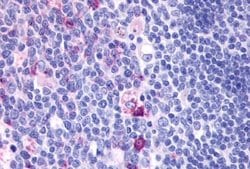 GPCR ORF4 Polyclonal Antibody, Invitrogen 25 &mu;g; Unconjugated:Antibodies,