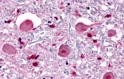 Invitrogen Opsin 3 Polyclonal Antibody 25 &mu;g; Unconjugated:Antibodies,