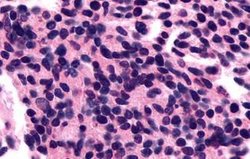 Invitrogen Opsin 3 Polyclonal Antibody 25 &mu;g; Unconjugated:Antibodies,