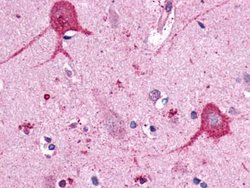 Invitrogen Opsin 3 Polyclonal Antibody 25 &mu;g; Unconjugated:Antibodies,