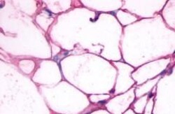 Invitrogen beta-3 Adrenergic Receptor Polyclonal Antibody 25 &mu;g; Unconjugated:Antibodies,