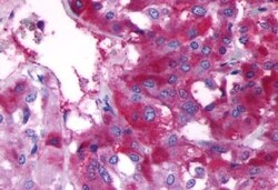 Invitrogen beta-3 Adrenergic Receptor Polyclonal Antibody 25 &mu;g; Unconjugated:Antibodies,