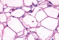 Invitrogen beta-3 Adrenergic Receptor Polyclonal Antibody 25 &mu;g; Unconjugated:Antibodies,