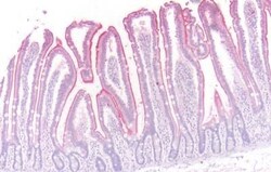 Invitrogen beta-3 Adrenergic Receptor Polyclonal Antibody 25 &mu;g; Unconjugated:Antibodies,