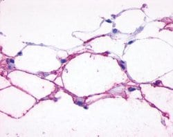 Invitrogen beta-3 Adrenergic Receptor Polyclonal Antibody 25 &mu;g; Unconjugated:Antibodies,