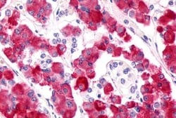 Invitrogen GPR17 Polyclonal Antibody 25 &mu;g; Unconjugated:Antibodies,