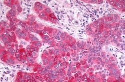 Invitrogen GPR17 Polyclonal Antibody 25 &mu;g; Unconjugated:Antibodies,