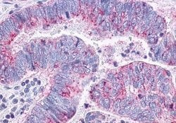 Invitrogen CCR10 Polyclonal Antibody 25 &mu;g | Buy Online | Invitrogen&trade; | Fisher Scientific