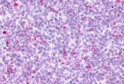 Invitrogen CCR10 Polyclonal Antibody 25 &mu;g | Buy Online | Invitrogen&trade; | Fisher Scientific