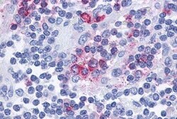 Invitrogen CCR10 Polyclonal Antibody 25 &mu;g | Buy Online | Invitrogen&trade; | Fisher Scientific