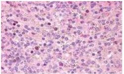 GPR171 Polyclonal Antibody, Invitrogen 25 &mu;g | Buy Online | Thermo Scientific | Fisher Scientific