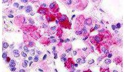 Invitrogen GPR12 Polyclonal Antibody 25 &mu;g; Unconjugated:Antibodies,