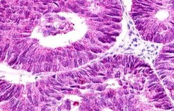 Invitrogen GPR12 Polyclonal Antibody 25 &mu;g; Unconjugated:Antibodies,