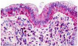 Invitrogen GPR160 Polyclonal Antibody 25 &mu;g; Unconjugated:Antibodies,