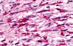 Invitrogen GPR160 Polyclonal Antibody 25 &mu;g; Unconjugated:Antibodies,