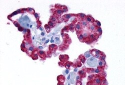 alpha-1d Adrenoceptor Polyclonal Antibody, Invitrogen 25 &mu;g; Unconjugated:Antibodies,