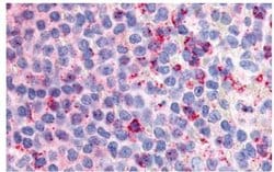 GPR132 Polyclonal Antibody, Invitrogen 25 &mu;g | Buy Online | Thermo Scientific | Fisher Scientific