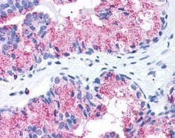 FZD1 Polyclonal Antibody, Invitrogen 25 &mu;g | Buy Online | Thermo Scientific | Fisher Scientific