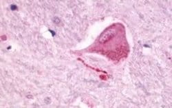 NMUR2 Polyclonal Antibody, Invitrogen 25 &mu;g; Unconjugated:Antibodies,