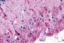 Invitrogen mGluR6 Polyclonal Antibody 25 &mu;g; Unconjugated:Antibodies,