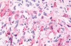 Invitrogen mGluR6 Polyclonal Antibody 25 &mu;g; Unconjugated:Antibodies,