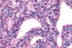 Invitrogen mGluR6 Polyclonal Antibody 25 &mu;g; Unconjugated:Antibodies,