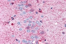 Invitrogen GPR108 Polyclonal Antibody 25 &mu;g | Buy Online | Invitrogen&trade; | Fisher Scientific