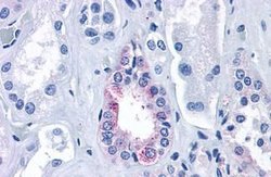 Invitrogen Calcium Sensing Receptor Polyclonal Antibody 25 &mu;g | Buy Online | Invitrogen&trade; | Fisher Scientific