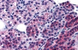 Invitrogen Calcium Sensing Receptor Polyclonal Antibody 25 &mu;g | Buy Online | Invitrogen&trade; | Fisher Scientific