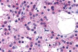 Invitrogen Calcium Sensing Receptor Polyclonal Antibody 25 &mu;g | Buy Online | Invitrogen&trade; | Fisher Scientific