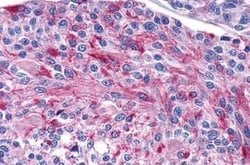 Invitrogen Calcium Sensing Receptor Polyclonal Antibody 25 &mu;g | Buy Online | Invitrogen&trade; | Fisher Scientific