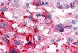 GPR133 Polyclonal Antibody, Invitrogen 25 &mu;g; Unconjugated:Antibodies,