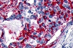 GPR133 Polyclonal Antibody, Invitrogen 25 &mu;g; Unconjugated:Antibodies,