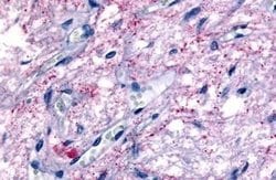 GPR50 Polyclonal Antibody, Invitrogen 25 &mu;g | Buy Online | Thermo Scientific | Fisher Scientific