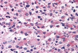 OXGR1 Polyclonal Antibody, Invitrogen 25 &mu;g; Unconjugated:Antibodies,