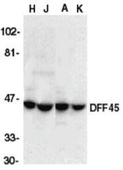 Invitrogen ICAD Polyclonal Antibody 100 &mu;g | Buy Online | Invitrogen&trade; | Fisher Scientific