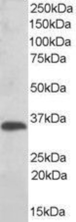 Invitrogen TMX Polyclonal Antibody 100 &mu;g; Unconjugated:Antibodies,