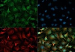 Invitrogen PHD2 Polyclonal Antibody 25 &mu;L; Unconjugated:Antibodies,