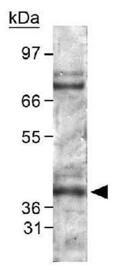 Invitrogen PHD2 Polyclonal Antibody 25 &mu;L; Unconjugated:Antibodies,
