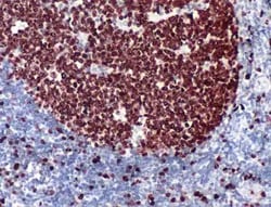 Invitrogen Ki-67 Polyclonal Antibody 1 mL | Buy Online | Invitrogen&trade; | Fisher Scientific