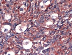 VEGF Polyclonal Antibody:Antibodies, Polyclonal