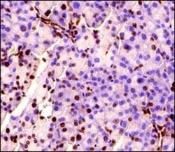 Invitrogen MECP2 Polyclonal Antibody 100 &mu;g; Unconjugated:Antibodies,
